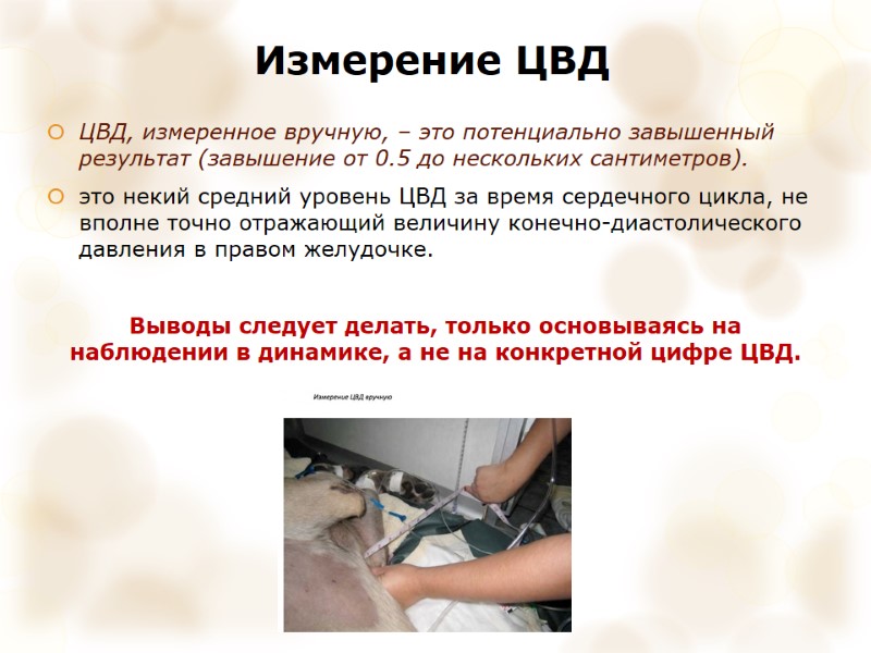 Измерение ЦВД ЦВД, измеренное вручную, – это потенциально завышенный результат (завышение от 0.5 до